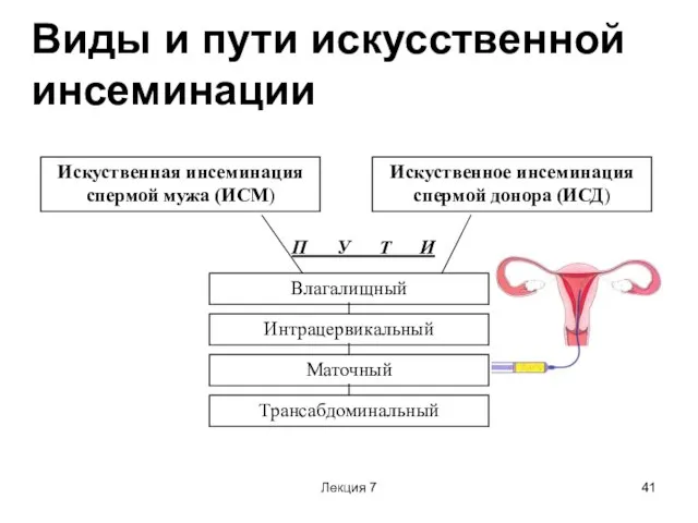 Лекция 7 Виды и пути искусственной инсеминации Искуственная инсеминация спермой мужа