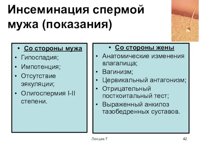 Лекция 7 Инсеминация спермой мужа (показания) Со стороны мужа Гипоспадия; Импотенция;