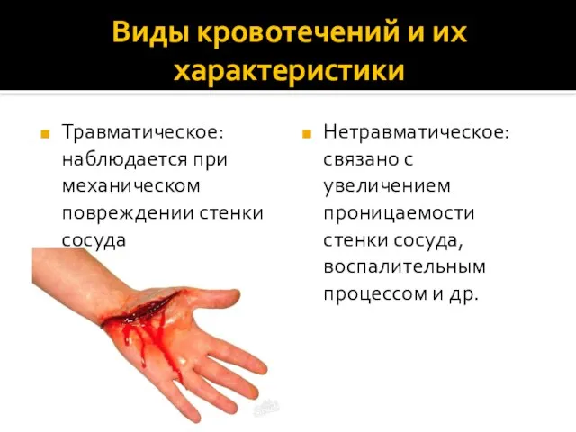 Виды кровотечений и их характеристики Травматическое: наблюдается при механическом повреждении стенки