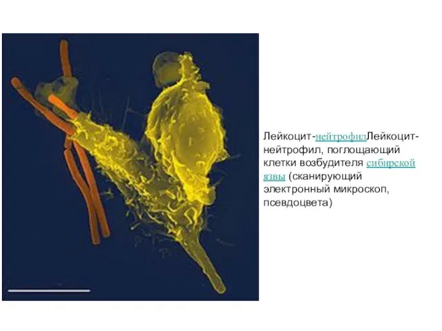 Лейкоцит-нейтрофилЛейкоцит-нейтрофил, поглощающий клетки возбудителя сибирской язвы (сканирующий электронный микроскоп, псевдоцвета)