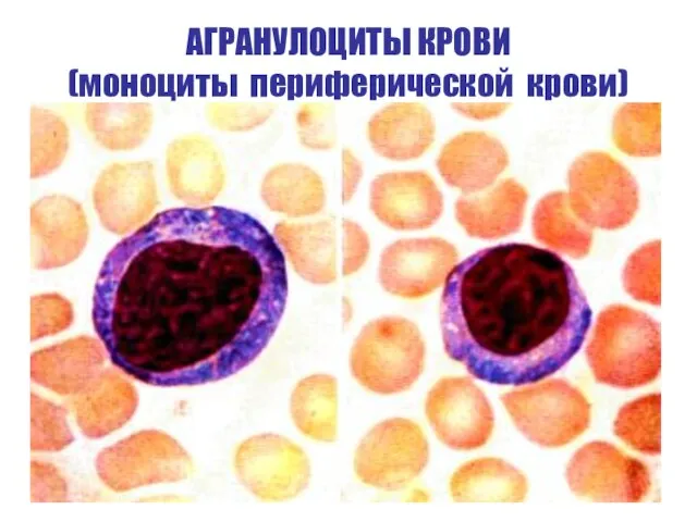 АГРАНУЛОЦИТЫ КРОВИ (моноциты периферической крови)