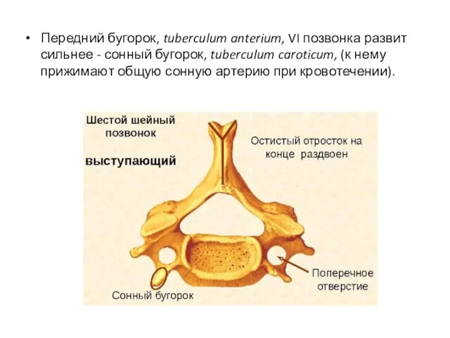 Передний бугорок, tuberculum anterium, VI позвонка развит сильнее - сонный бугорок,