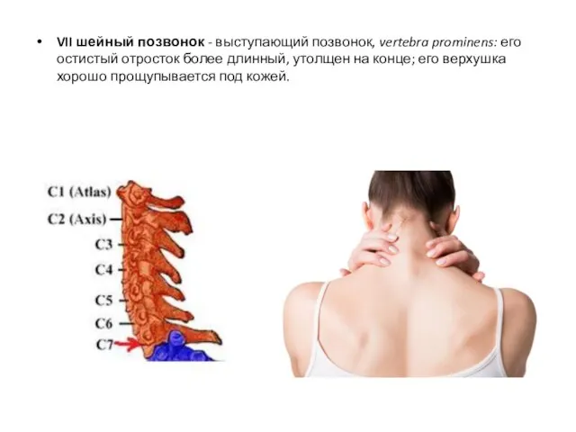 VII шейный позвонок - выступающий позвонок, vertebra prominens: его остистый отросток