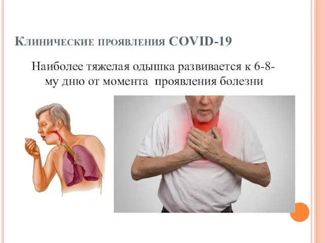 Клинические проявления COVID-19 Наиболее тяжелая одышка развивается к 6-8-му дню от момента проявления болезни