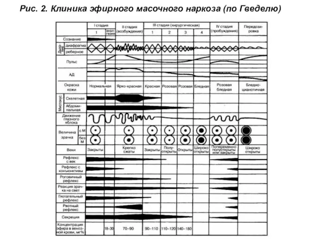 Рис. 2. Клиника эфирного масочного наркоза (по Гведелю)