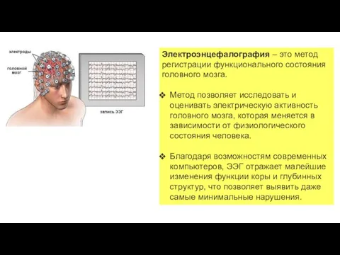 Электроэнцефалография – это метод регистрации функционального состояния головного мозга. Метод позволяет
