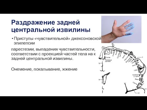 Раздражение задней центральной извилины Приступы «чувствительной» джексоновской эпилепсии парестезии, выпадения чувствительности,