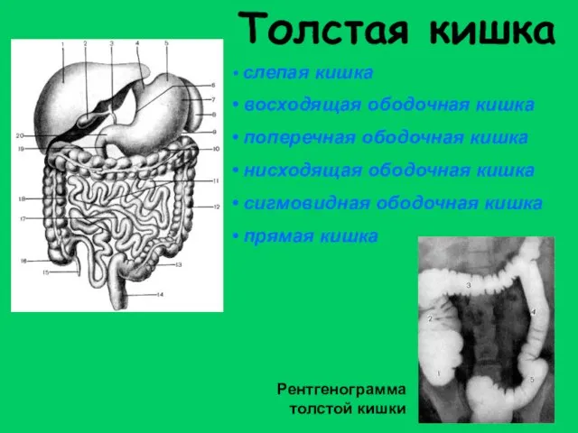 Толстая кишка слепая кишка восходящая ободочная кишка поперечная ободочная кишка нисходящая