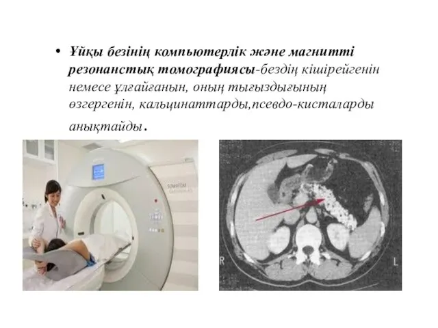 Ұйқы безінің компьютерлік және магнитті резонанстық томографиясы-бездің кішірейгенін немесе ұлғайғанын, оның тығыздығының өзгергенін, кальцинаттарды,псевдо-кисталарды анықтайды.