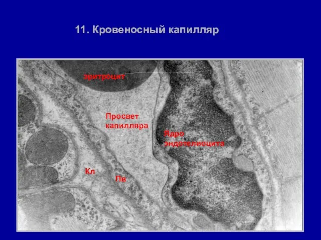 11. Кровеносный капилляр Просвет капилляра Ядро эндотелиоцита эритроцит Пв Кл