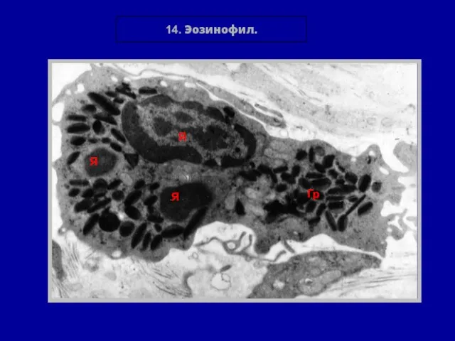 14. Эозинофил. Я Я Я Гр