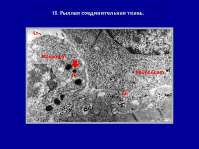 16. Рыхлая соединительная ткань. Фибробласт. Макрофаг. Лс Кл Кл