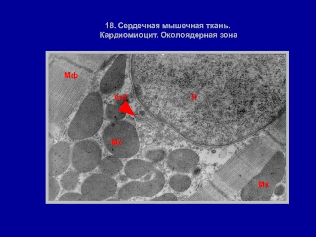 Я Мх АпГ Мф 18. Сердечная мышечная ткань. Кардиомиоцит. Околоядерная зона Мх