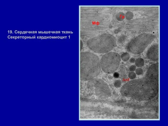 АпГ Гр Мф 19. Сердечная мышечная ткань Секреторный кардиомиоцит 1