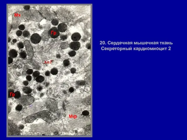 20. Сердечная мышечная ткань Секреторный кардиомиоцит 2 Гр АпГ Гр Мф Мх