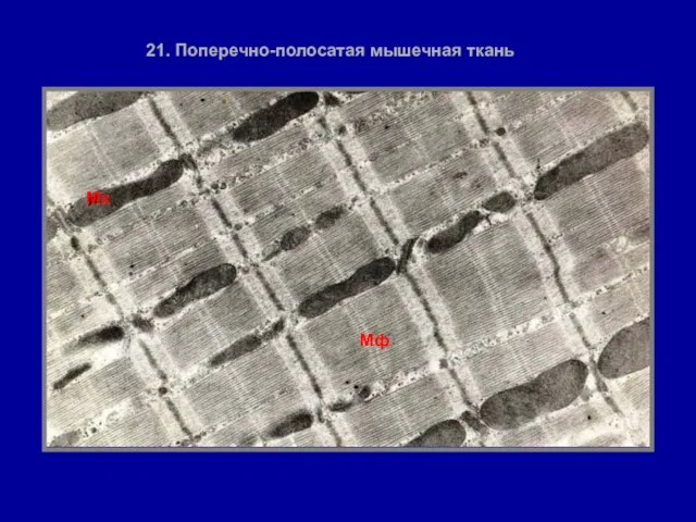 21. Поперечно-полосатая мышечная ткань Мф Мх