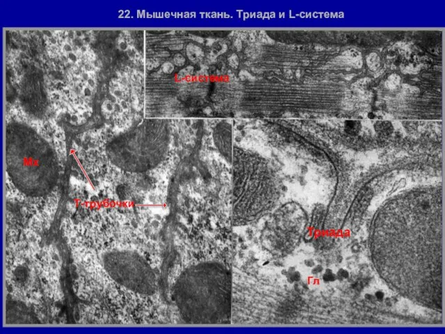 Т-трубочки Триада L-система 22. Мышечная ткань. Триада и L-система Мх Гл