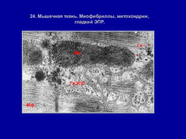 24. Мышечная ткань. Миофибриллы, митохондрии, гладкий ЭПР. Мх Мф Гл ГлЭПС