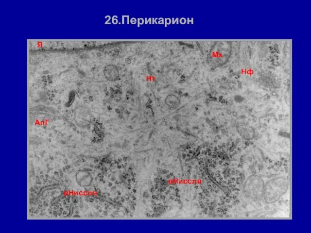 26.Перикарион АпГ Мх Нф Я вНиссля вНиссля Нт