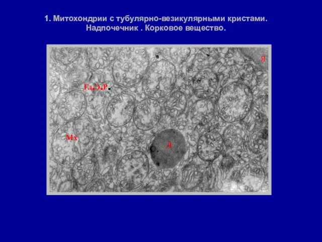 1. Митохондрии с тубулярно-везикулярными кристами. Надпочечник . Корковое вещество. Мх Л Я Гл.Э.Р.