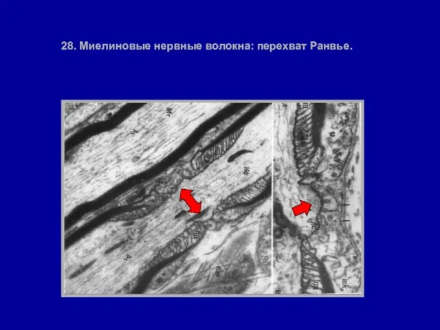 28. Миелиновые нервные волокна: перехват Ранвье.