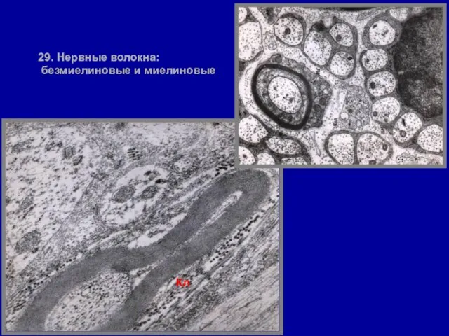 29. Нервные волокна: безмиелиновые и миелиновые Кл