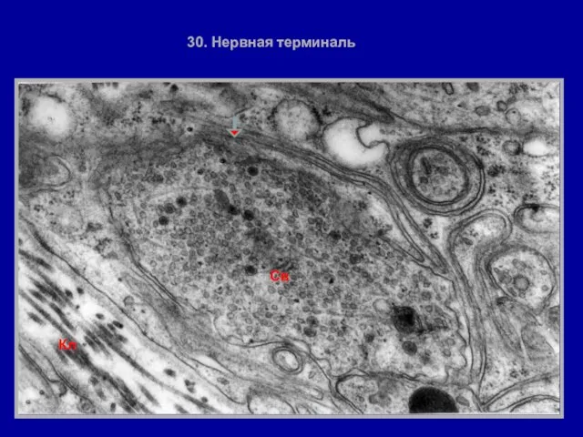 30. Нервная терминаль Св Кл