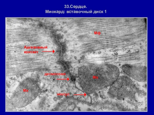 Мф Мх Мх десмосома нексус 33.Сердце. Миокард: вставочный диск 1 Адгезивный контакт Адгезивный контакт