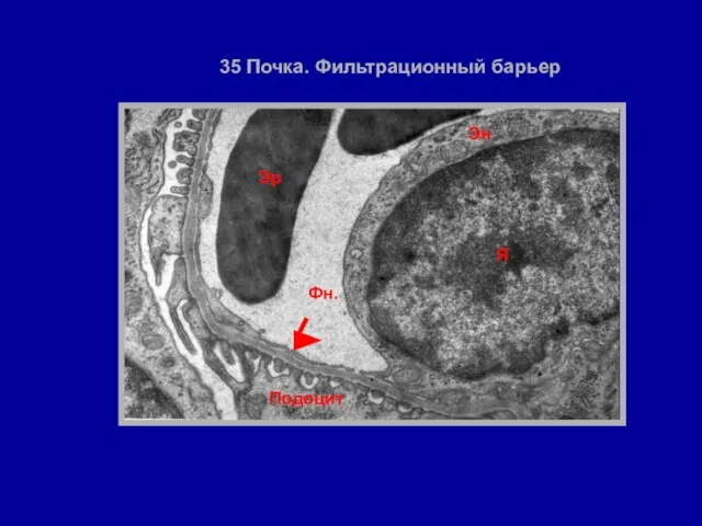 Эн Эр Подоцит Фн. 35 Почка. Фильтрационный барьер Я