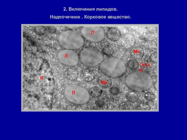 2. Включения липидов. Надпочечник . Корковое вещество. Я Л Мх Мх Гл.Э.Р. Л Л