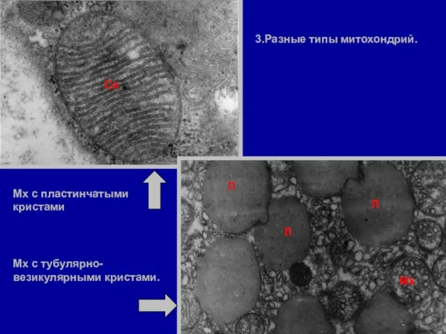 3.Разные типы митохондрий. Мх с тубулярно- везикулярными кристами. Мх с пластинчатыми