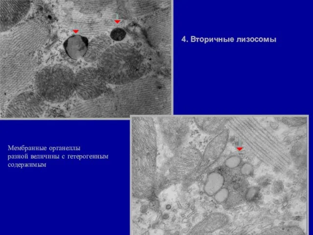 4. Вторичные лизосомы Мембранные органеллы разной величины с гетерогенным содержимым