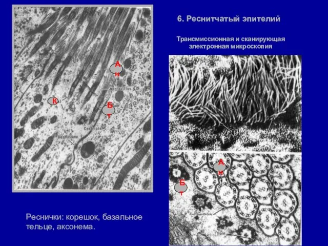 6. Реснитчатый эпителий Реснички: корешок, базальное тельце, аксонема. Трансмиссионная и сканирующая