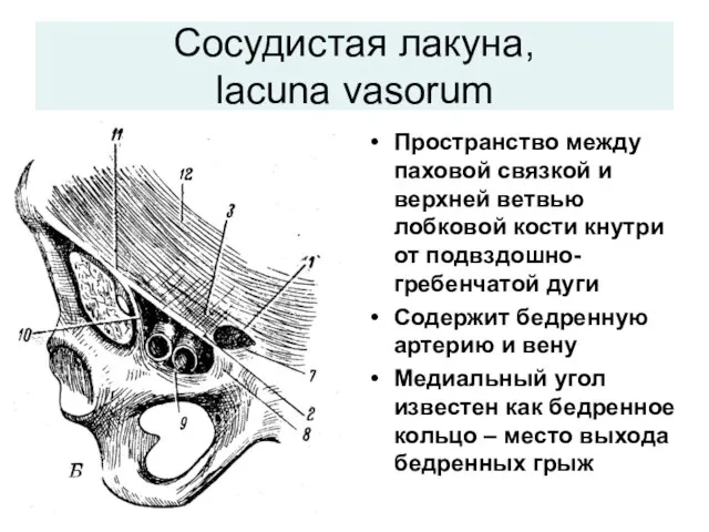 Сосудистая лакуна, lacuna vasorum Пространство между паховой связкой и верхней ветвью