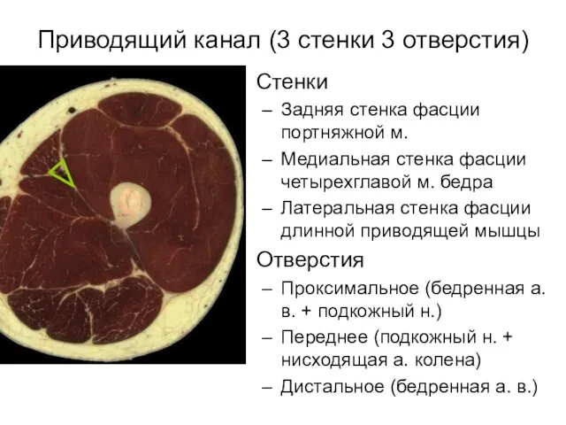 Приводящий канал (3 стенки 3 отверстия) Стенки Задняя стенка фасции портняжной