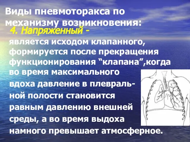 Виды пневмоторакса по механизму возникновения: является исходом клапанного, формируется после прекращения