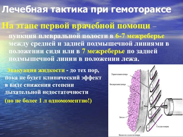 Лечебная тактика при гемотораксе На этапе первой врачебной помощи – пункция