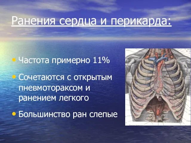 Ранения сердца и перикарда: Частота примерно 11% Сочетаются с открытым пневмотораксом