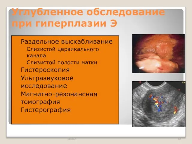 Углубленное обследование при гиперплазии Э Раздельное выскабливание Слизистой цервикального канала Слизистой