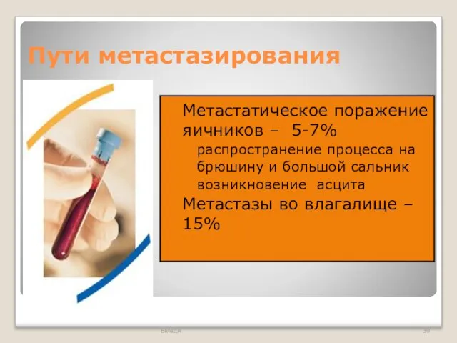 Пути метастазирования Метастатическое поражение яичников – 5-7% распространение процесса на брюшину