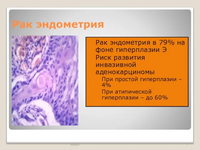 Рак эндометрия Рак эндометрия в 79% на фоне гиперплазии Э Риск