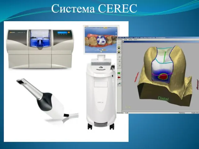 Система CEREC