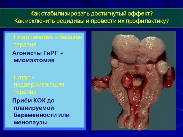 Как стабилизировать достигнутый эффект? Как исключить рецидивы и провести их профилактику?