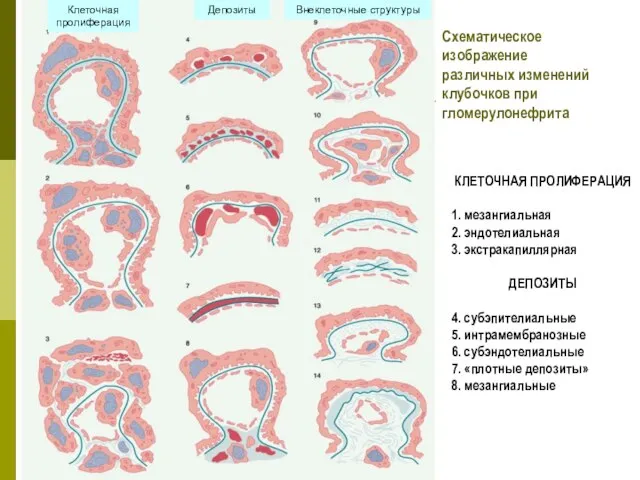 Клеточная пролиферация Депозиты Внеклеточные структуры КЛЕТОЧНАЯ ПРОЛИФЕРАЦИЯ 1. мезангиальная 2. эндотелиальная