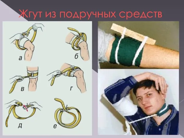 Жгут из подручных средств