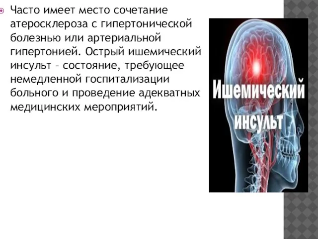 Часто имеет место сочетание атеросклероза с гипертонической болезнью или артериальной гипертонией.