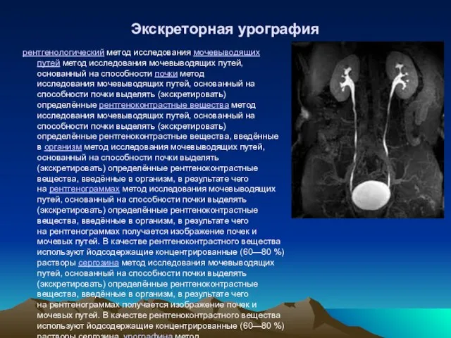 Экскреторная урография рентгенологический метод исследования мочевыводящих путей метод исследования мочевыводящих путей,