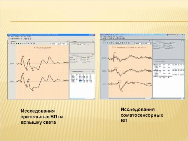 Исследования соматосенсорных ВП Исследования зрительных ВП на вспышку света