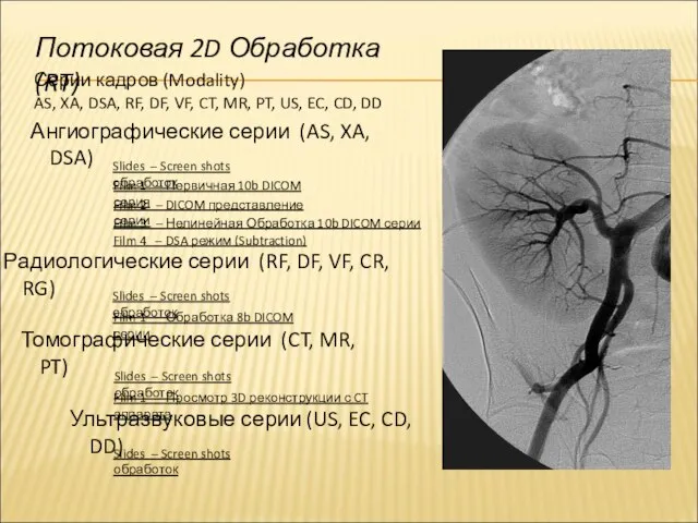 Радиологические серии (RF, DF, VF, CR, RG) Slides – Screen shots