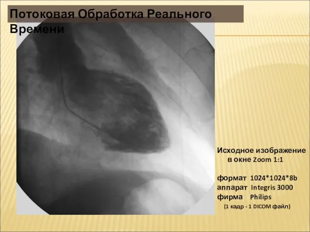 Исходное изображение в окне Zoom 1:1 формат 1024*1024*8b аппарат Integris 3000